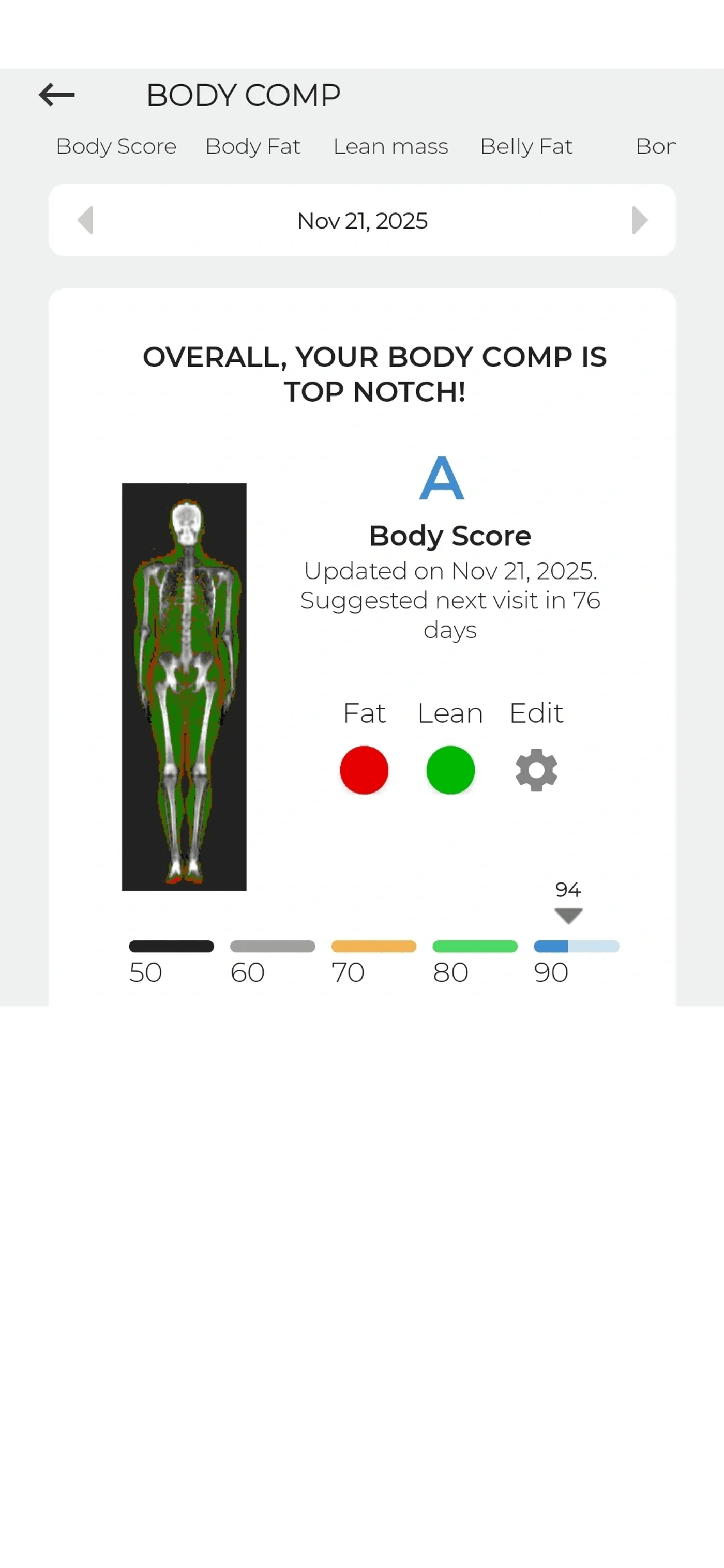 DEXA report: body composition summary overview